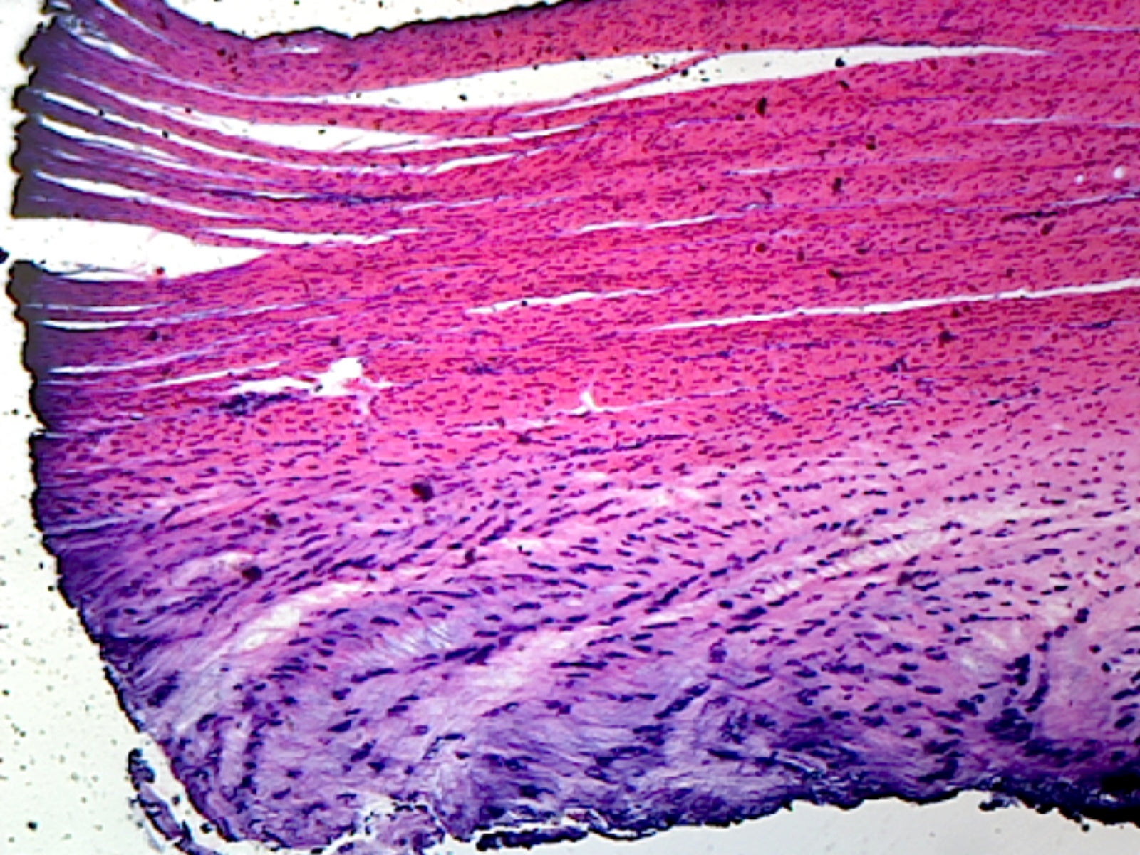 Gsc International White Fibrocartilage From Intervertebral Disc ...