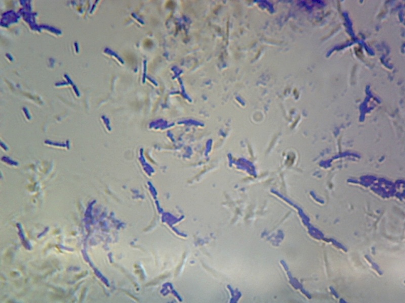 Gsc International Bacillus Subtilis Spore Forming Smear Gram Positive
