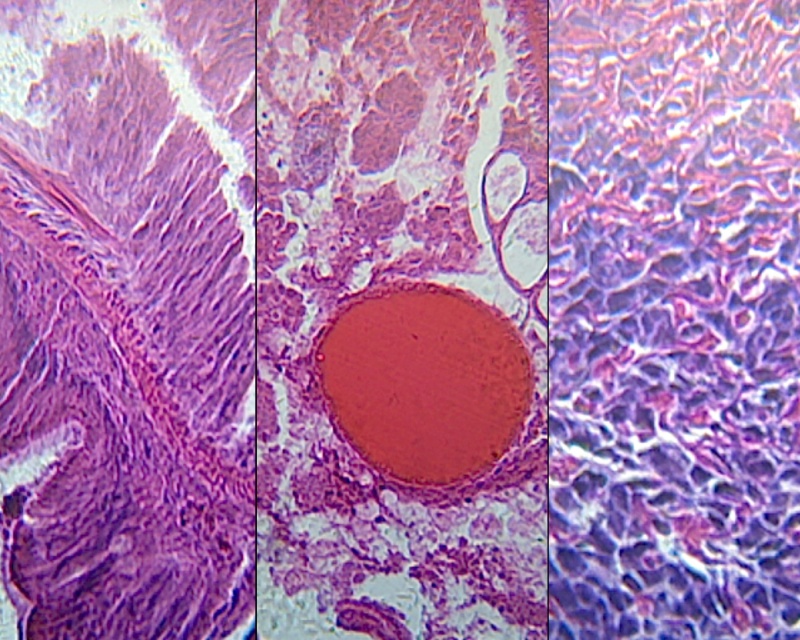 Earthworm (Anellids), Composite Of Pharynx, Intestine, And Head Region ...