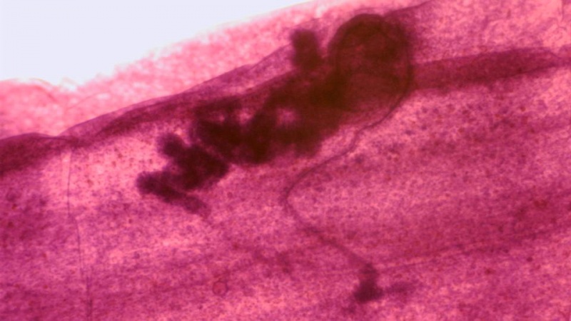 gsc-international-taenia-immature-proglottid-from-cow-or-sheep